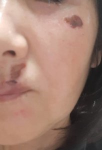 使用３日目